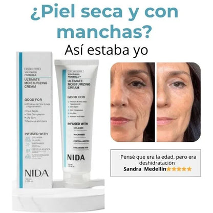 NIDA-Despídete de las manchas oscuras y vuelve a sentir tu piel uniforme y luminosa