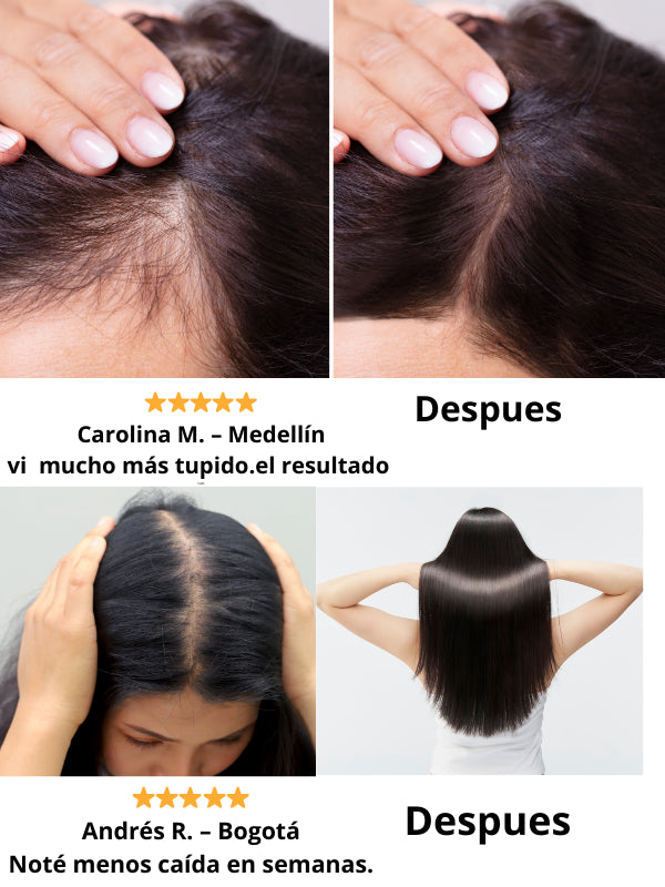 Shampoo Batana Anticaída Raíz Fuerte