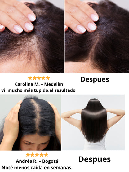 Shampoo Batana Anticaída Raíz Fuerte