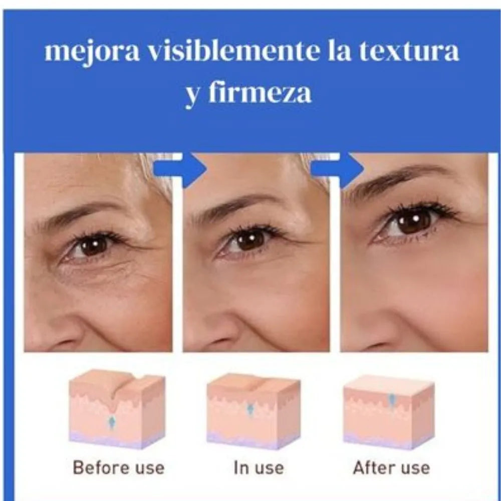 Botox Stock Solution  Antiarrugas  el Original